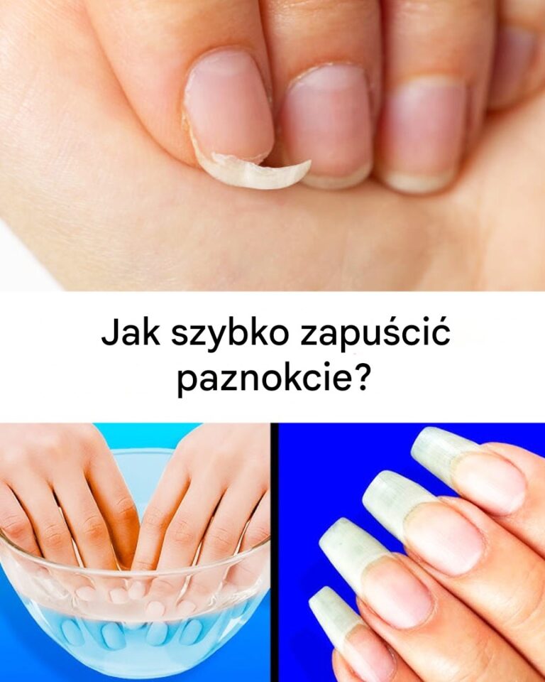 Naturalna_kuracja_dla_d_oni__domowy_spos_b_na_szybszy_wzrost_paznokci
