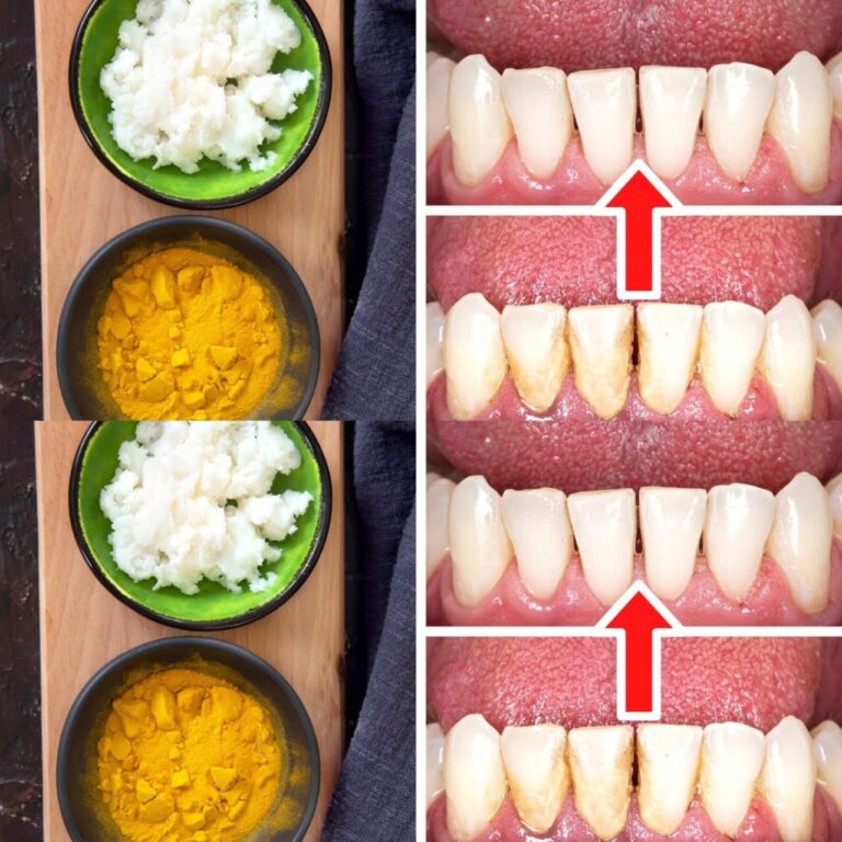 Naturalne_Czyszczenie_Z_b_w__Jak_Usun___Kamie__Naz_bny_Bez_Dentysty_z_Kurkum__i_Sol_