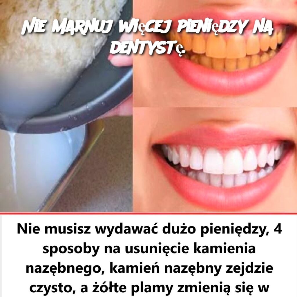 Nie_marnuj_wi_cej_pieni_dzy_na_dentyst__ Nie_marnuj_wi_cej_pieni_dzy_na_dentyst__
