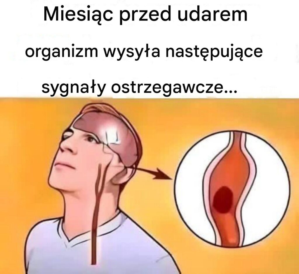 Objawy_udaru__jakie_s__sygna_y_ostrzegawcze_ Objawy_udaru__jakie_s__sygna_y_ostrzegawcze_