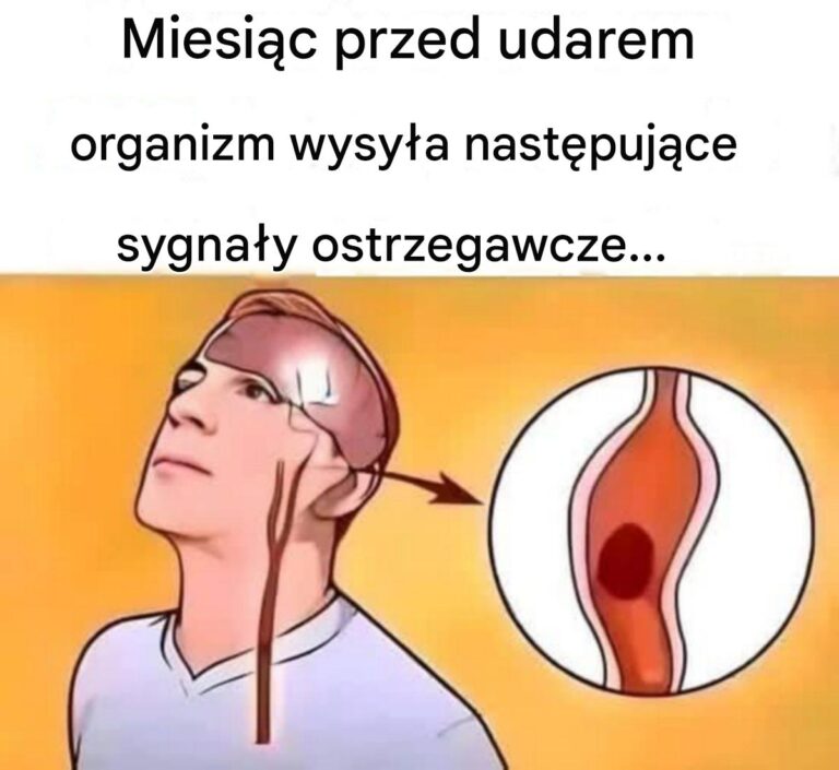 Objawy_udaru__jakie_s__sygna_y_ostrzegawcze_