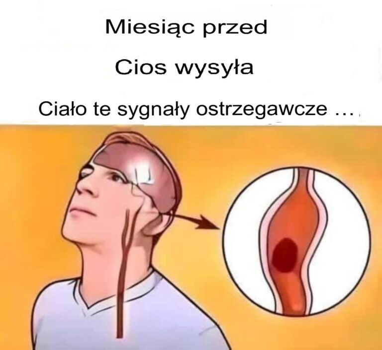 Objawy_udaru__poznaj_sygna_y_ostrzegawcze__kt_re_mog__uratowa___ycie____