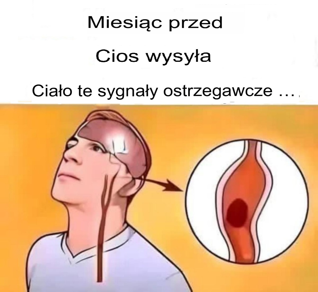 Objawy_udaru__poznaj_sygna_y_ostrzegawcze__kt_re_mog__uratowa___ycie____ Objawy_udaru__poznaj_sygna_y_ostrzegawcze__kt_re_mog__uratowa___ycie____