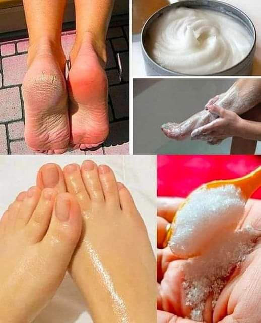 Oto_jak_wykona__pedicure_w_domu_przy_u_yciu_sody_oczyszczonej Oto_jak_wykona__pedicure_w_domu_przy_u_yciu_sody_oczyszczonej