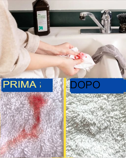 PLAMY_KRWI_NA_R_CZNIKACH__JAK__ATWO_JE_USUN__-1 PLAMY_KRWI_NA_R_CZNIKACH__JAK__ATWO_JE_USUN__-1