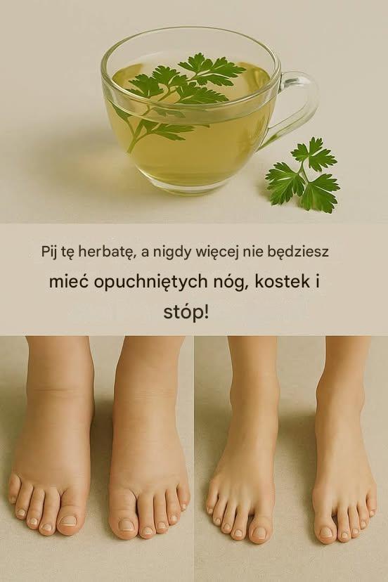 Si_a_herbaty_pietruszkowej__naturalna_ulga_w_obrz_kach_n_g__kostek_i_st_p Si_a_herbaty_pietruszkowej__naturalna_ulga_w_obrz_kach_n_g__kostek_i_st_p