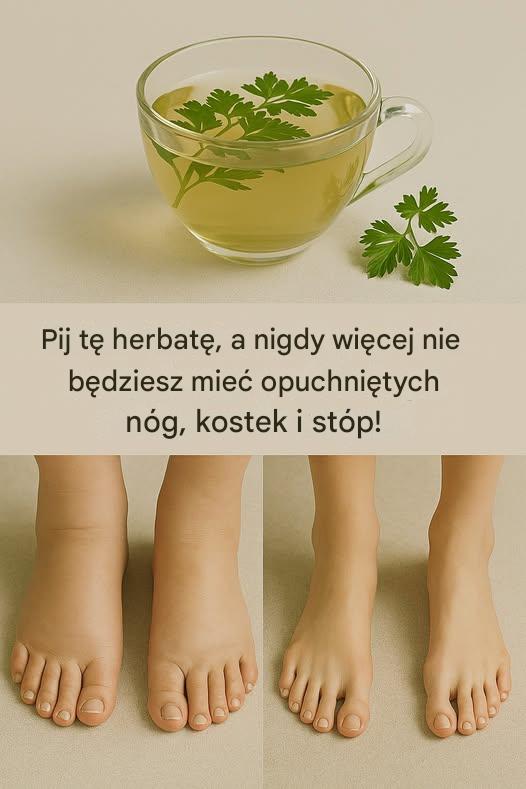 Si_a_herbaty_z_pietruszki__naturalna_ulga_w_obrz_kach_n_g__kostek_i_st_p Si_a_herbaty_z_pietruszki__naturalna_ulga_w_obrz_kach_n_g__kostek_i_st_p