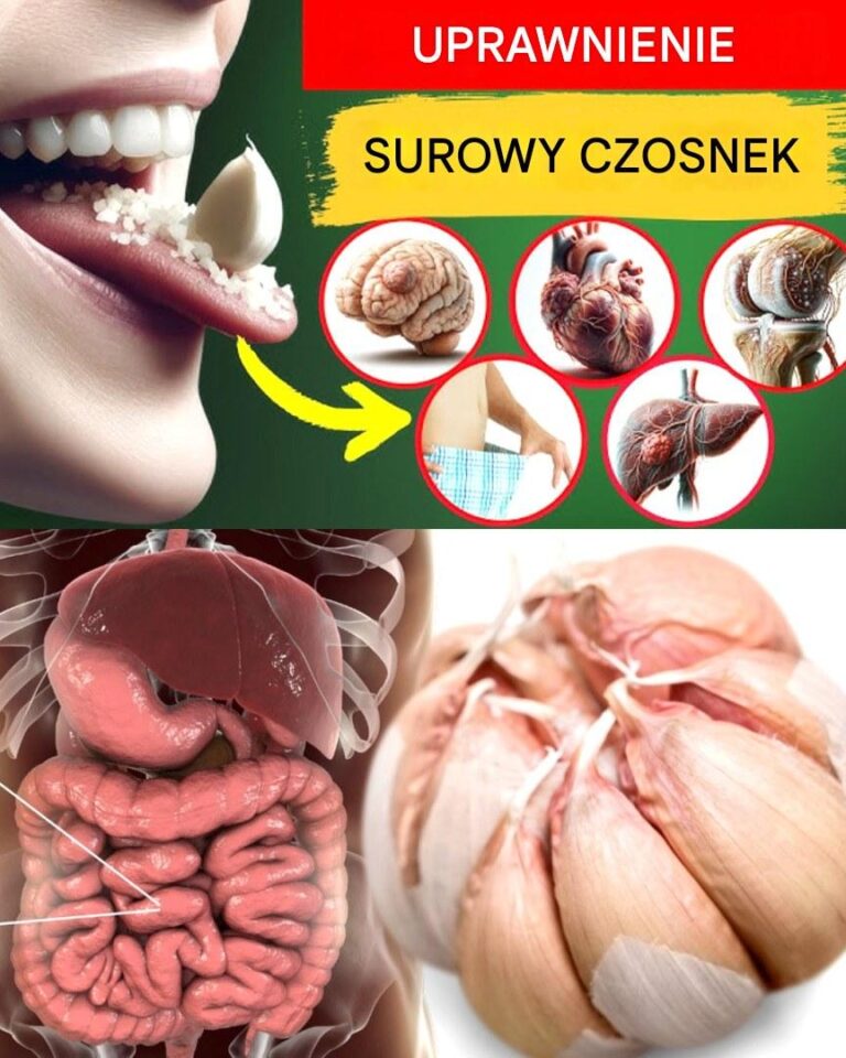 Surowy_czosnek___Naturalny_Booster_Zdrowia__Kt_ry_Zmie_ci_si__w_D_oni