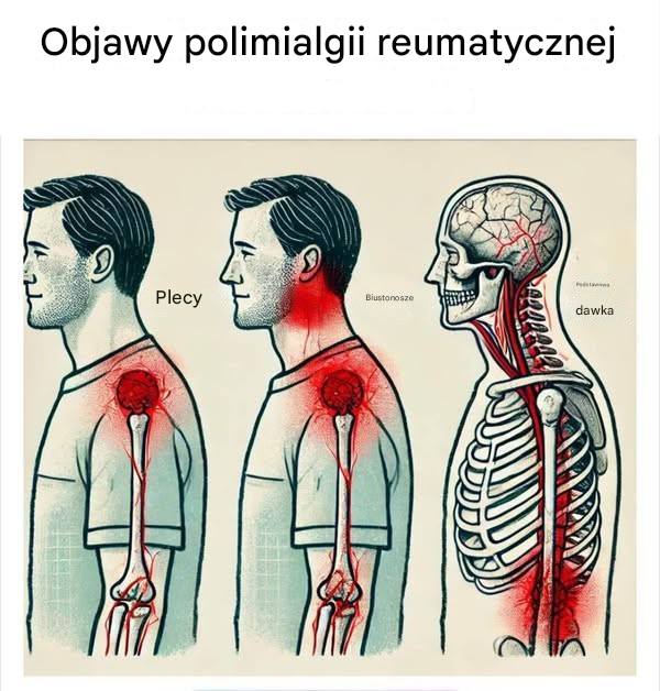 Sygna_y_ostrzegawcze_wyniszczaj_cej_choroby_zapalnej_u_os_b_starszych Sygna_y_ostrzegawcze_wyniszczaj_cej_choroby_zapalnej_u_os_b_starszych