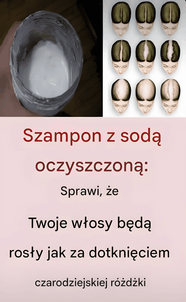 Szampon_z_sod__oczyszczon___magiczne_rozwi_zanie_na_porost_w_os_w