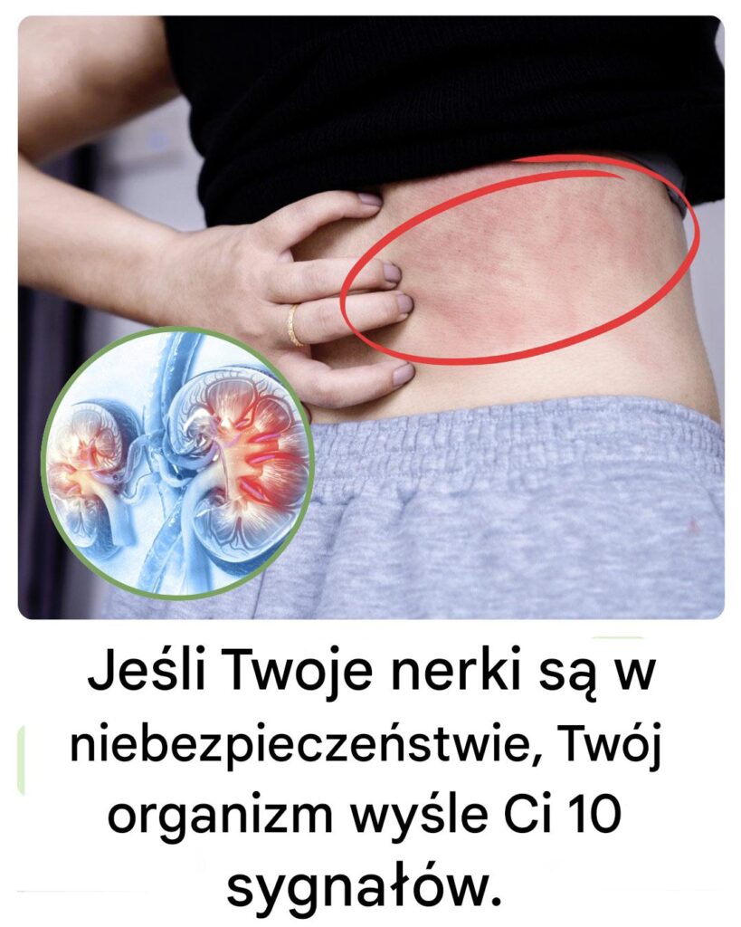 Twoje_cia_o_wy_le___Ci_te_10_znak_w__je_li_Twoje_nerki_s__w_niebezpiecze_stwie Twoje_cia_o_wy_le___Ci_te_10_znak_w__je_li_Twoje_nerki_s__w_niebezpiecze_stwie