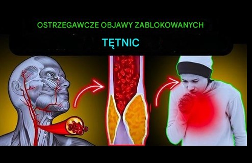 Tytu___Ostrzegawcze_Objawy_Zab_o_onych_T_tnic___Jak_Rozpozna__Problemy_z_Kr__eniem Tytu___Ostrzegawcze_Objawy_Zab_o_onych_T_tnic___Jak_Rozpozna__Problemy_z_Kr__eniem