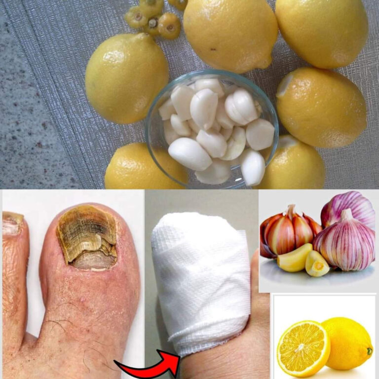 rodki_z_cytryny_i_czosnku_na_grzybic__paznokci_i_nadmierne_pocenie