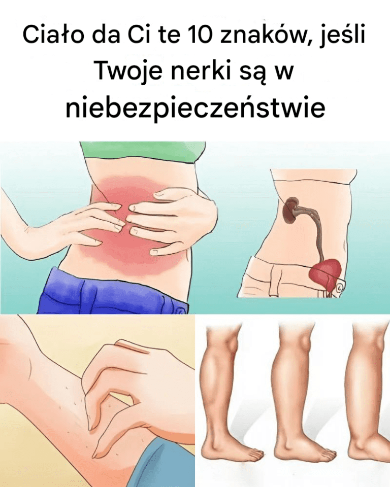 10_objaw_w_choroby_nerek 10_objaw_w_choroby_nerek