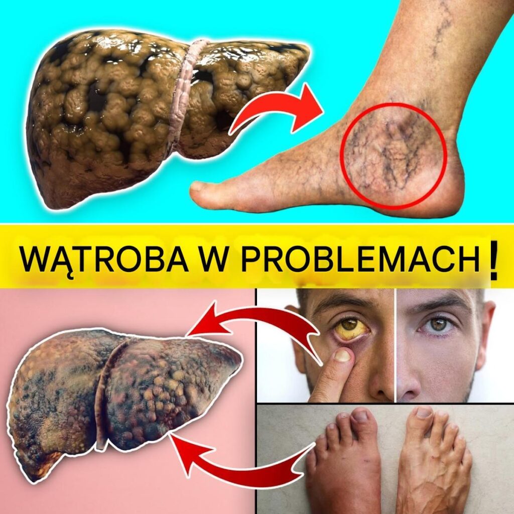 15_wczesnych_ostrzegawczych_znak_w___e_Twoja_w_troba_mo_e_mie__problemy 15_wczesnych_ostrzegawczych_znak_w___e_Twoja_w_troba_mo_e_mie__problemy