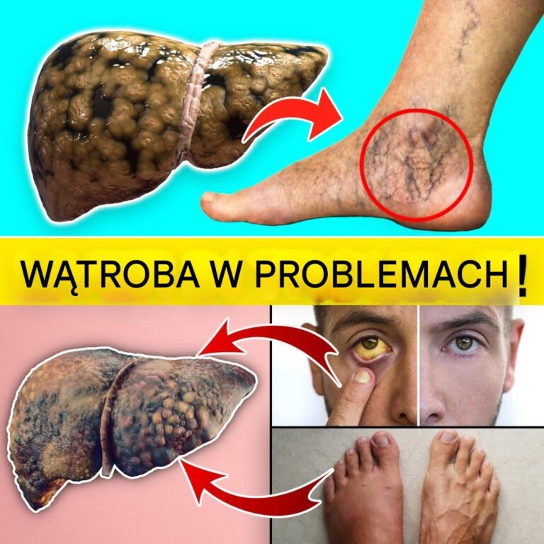 15_wczesnych_ostrzegawczych_znak_w___e_Twoja_w_troba_mo_e_mie__problemy