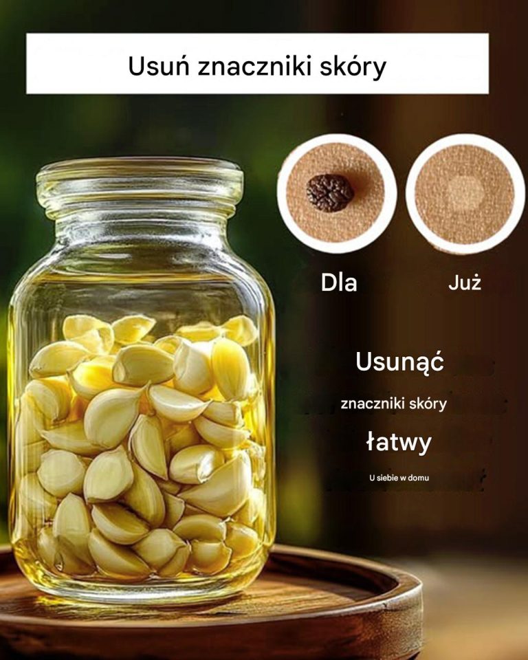 3_domowe_sposoby_na_pozbycie_si__naro_li_sk_rnych-1 3_domowe_sposoby_na_pozbycie_si__naro_li_sk_rnych-1