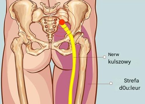 4_skuteczne_ruchy__agodz_ce_b_l_nerwu_kulszowego_i__agodz_ce_b_l_dolnej_cz__ci_plec_w_poprzez_rozlu_nienie_mi__nia_gruszkowatego 4_skuteczne_ruchy__agodz_ce_b_l_nerwu_kulszowego_i__agodz_ce_b_l_dolnej_cz__ci_plec_w_poprzez_rozlu_nienie_mi__nia_gruszkowatego