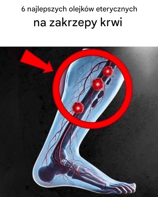 6_najlepszych_olejk_w_do_naturalnego_rozpuszczania_skrzep_w_krwi 6_najlepszych_olejk_w_do_naturalnego_rozpuszczania_skrzep_w_krwi