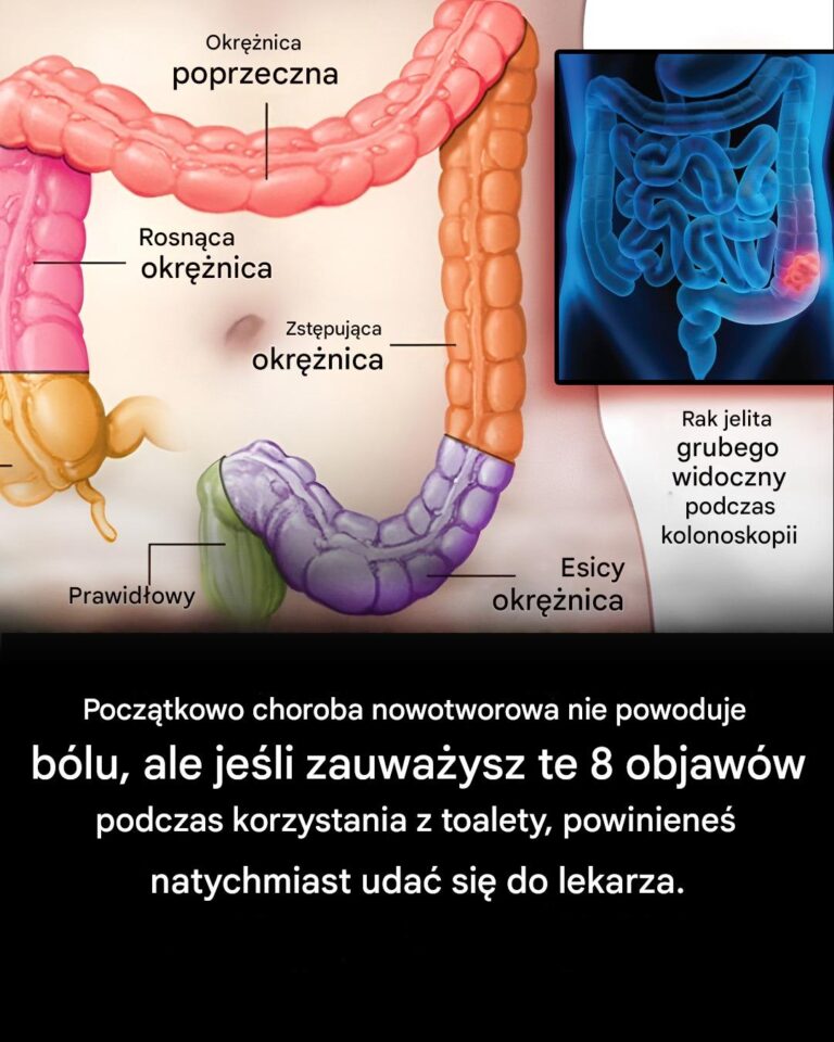 7_ostrzegawczych_objaw_w_raka_jelita_grubego__kt_rych_nigdy_nie_nale_y_ignorowa_