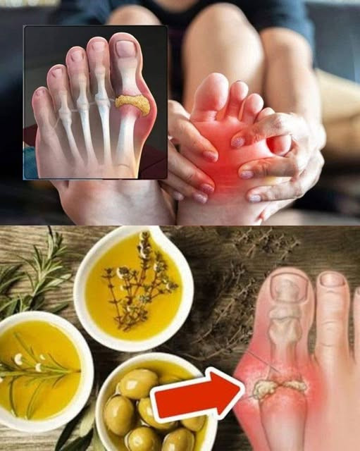 8_prostych_sposob_w_na_naturalne_zmniejszenie_nadmiaru_kwasu_moczowego 8_prostych_sposob_w_na_naturalne_zmniejszenie_nadmiaru_kwasu_moczowego