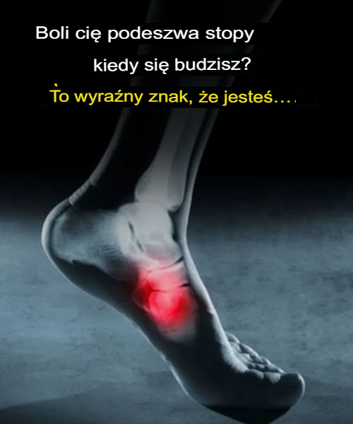 B_l_w_podeszwie_stopy_po_przebudzeniu__Uwa_aj_na_ten_mo_liwy_objaw_niebezpiecznej_choroby_ B_l_w_podeszwie_stopy_po_przebudzeniu__Uwa_aj_na_ten_mo_liwy_objaw_niebezpiecznej_choroby_