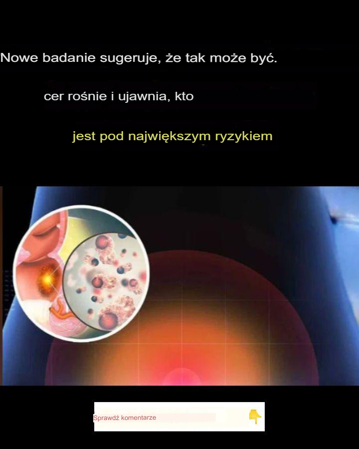 Badania_wskazuj____e_zachorowalno___na_raka_odbytu_ro_nie__ujawniaj_c__kto_jest_najbardziej_na_niego_nara_ony_ Badania_wskazuj____e_zachorowalno___na_raka_odbytu_ro_nie__ujawniaj_c__kto_jest_najbardziej_na_niego_nara_ony_