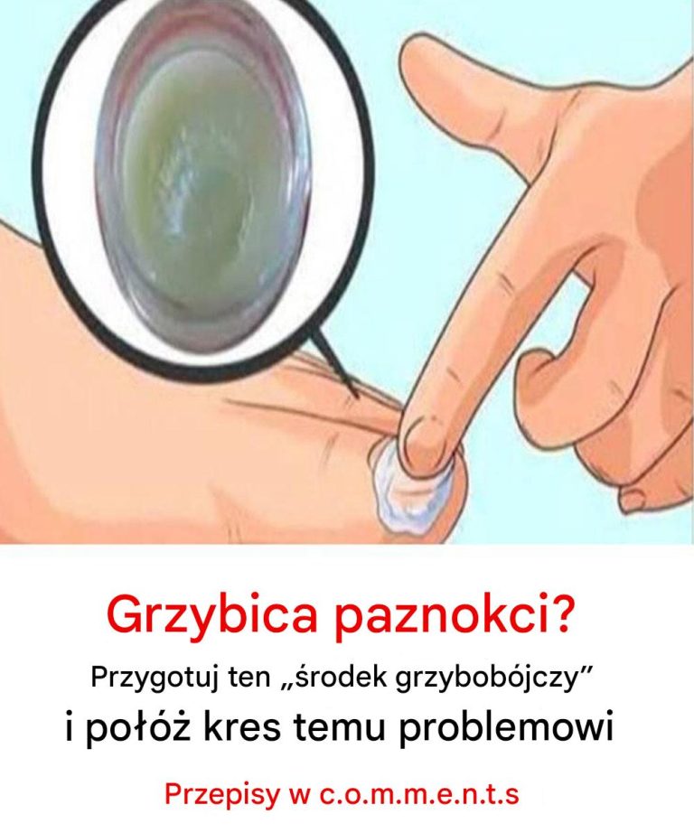 Grzybica_paznokci__Przygotuj_ten__fungus_k_iller__i_po____kres_temu_problemowi Grzybica_paznokci__Przygotuj_ten__fungus_k_iller__i_po____kres_temu_problemowi