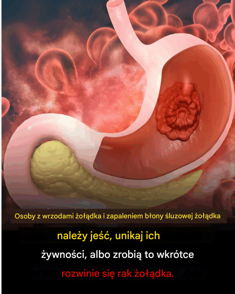 Jaka_jest_idealna_dieta_w_przypadku_wrzod_w__o__dka_i_zapalenia_b_ony__luzowej__o__dka_
