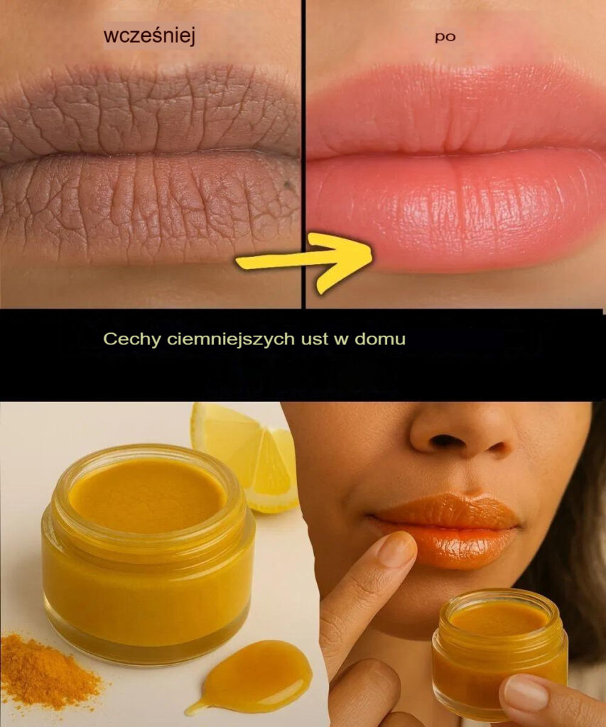 Leczenie_ciemnych_ust_w_domu Leczenie_ciemnych_ust_w_domu