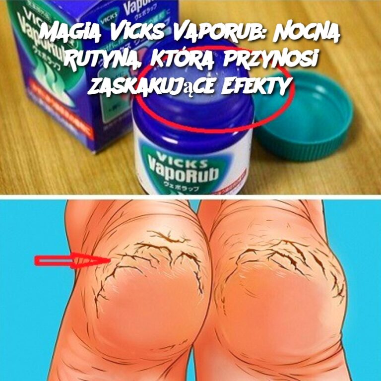 Magia_Vicks_Vaporub__Nocna_Rutyna__Kt_ra_Przynosi_Zaskakuj_ce_Efekty