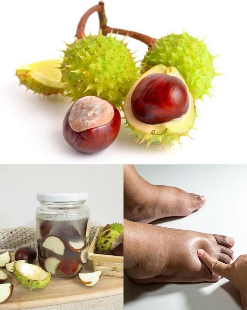 Najskuteczniejszy_naturalny__rodek_na_opuchni_te_nogi_i_nie_tylko Najskuteczniejszy_naturalny__rodek_na_opuchni_te_nogi_i_nie_tylko
