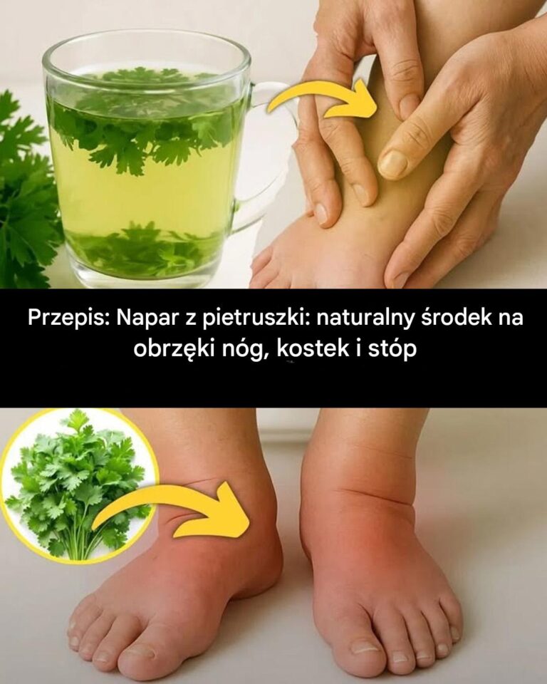 Napar_z_pietruszki__naturalny__rodek_na_obrz_ki_n_g__kostek_i_st_p
