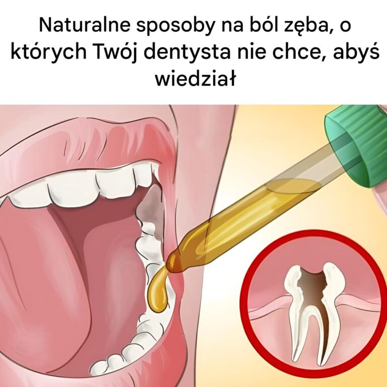 Naturalne_sposoby_na_b_l_z_ba