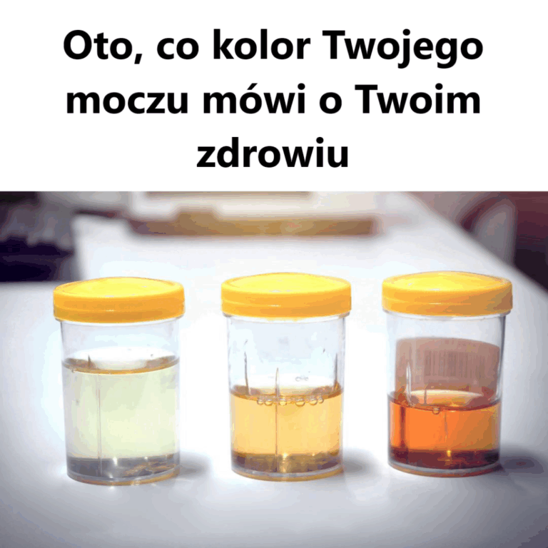 Oto__co_kolor_Twojego_moczu_m_wi_o_Twoim_zdrowiu-1
