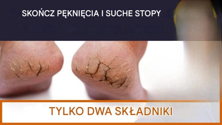 POZB_D__SI__P_KAJ_CYCH_ST_P_za_pomoc__zaledwie_2_sk_adnik_w_i_zachowaj_swoje_stopy_mi_kkie