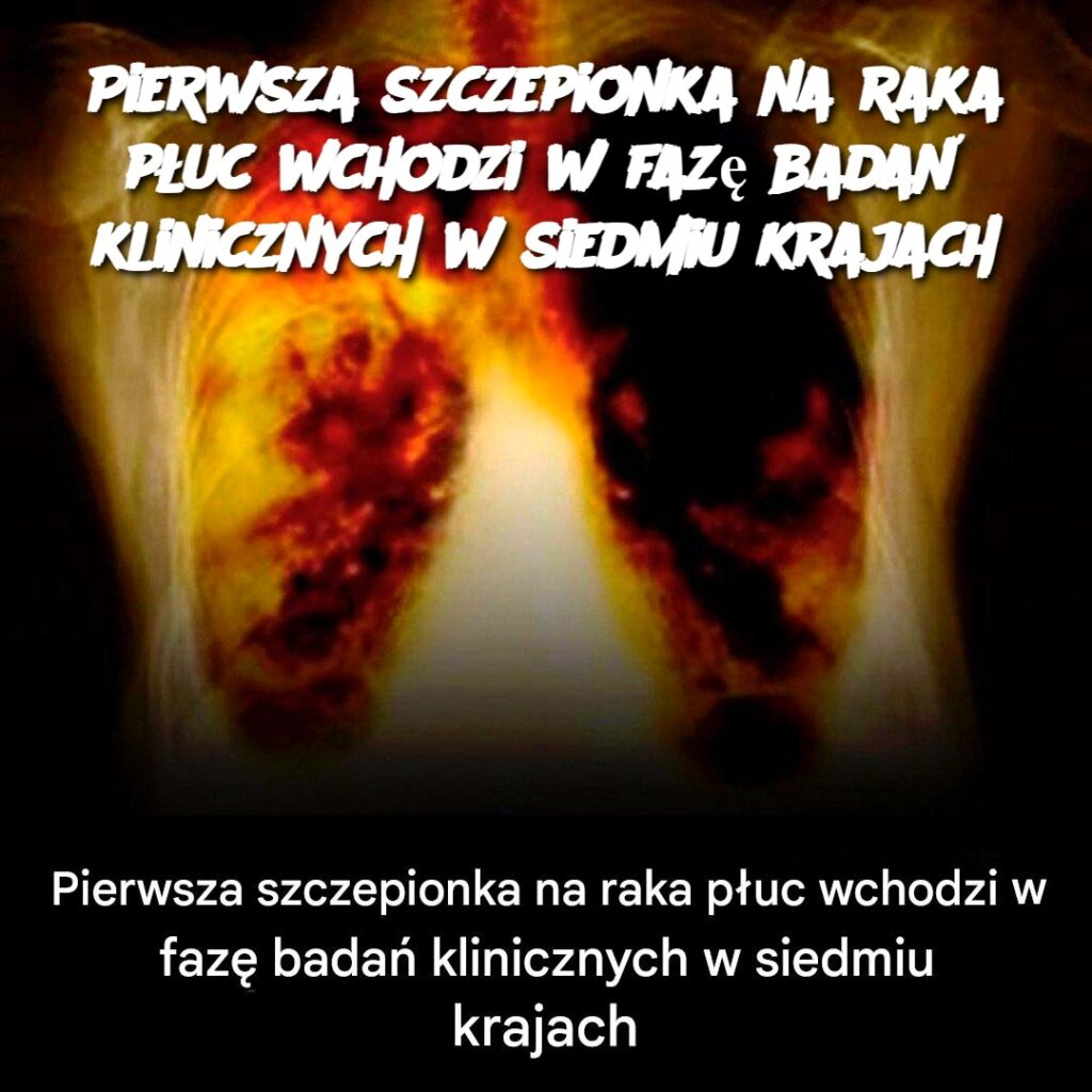 Pierwsza_szczepionka_na_raka_p_uc_wchodzi_w_faz__bada__klinicznych_w_siedmiu_krajach