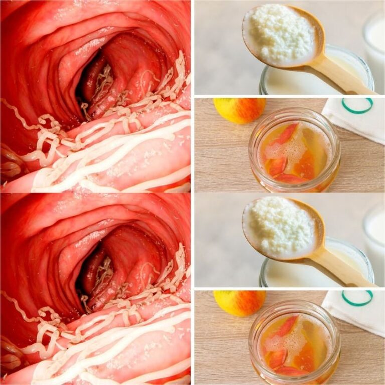 Pokonaj_robaki_jelitowe_naturalnie__5_produkt_w__kt_re_pomog__ci_w_walce_