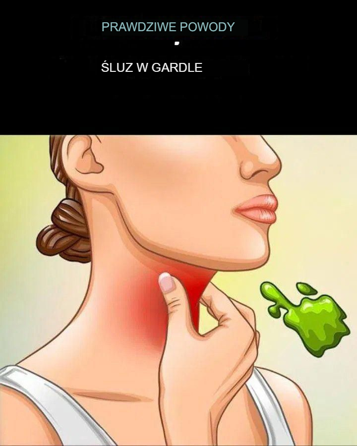 Prawdziwe_przyczyny__luzu_w_gardle_i_jak_si__go_pozby__w_spos_b_naturalny Prawdziwe_przyczyny__luzu_w_gardle_i_jak_si__go_pozby__w_spos_b_naturalny