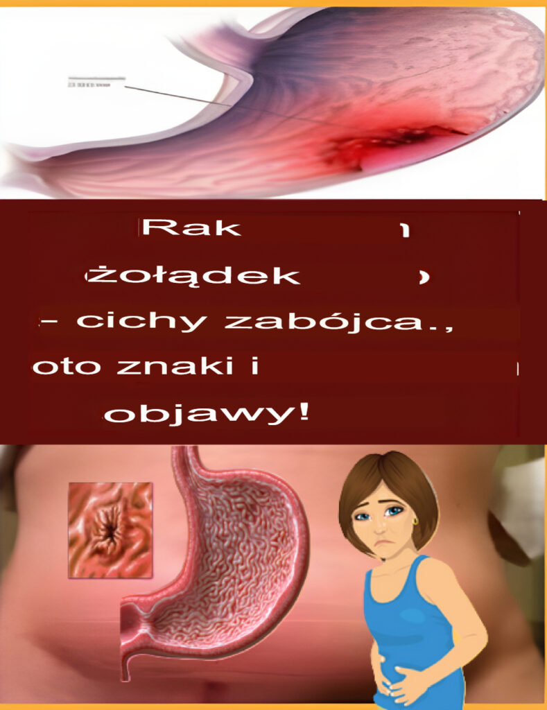 Rak__o__dka__Cichy_Zab_jca__Oto_Znaki_I_Symptomy_ Rak__o__dka__Cichy_Zab_jca__Oto_Znaki_I_Symptomy_