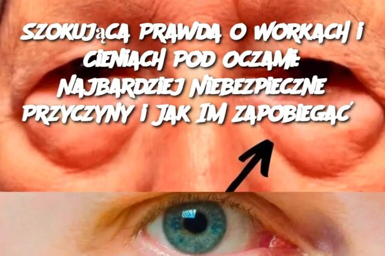 Szokuj_ca_Prawda_o_Workach_i_Cieniach_Pod_Oczami__Najbardziej_Niebezpieczne_Przyczyny_i_Jak_Im_Zapobiega_