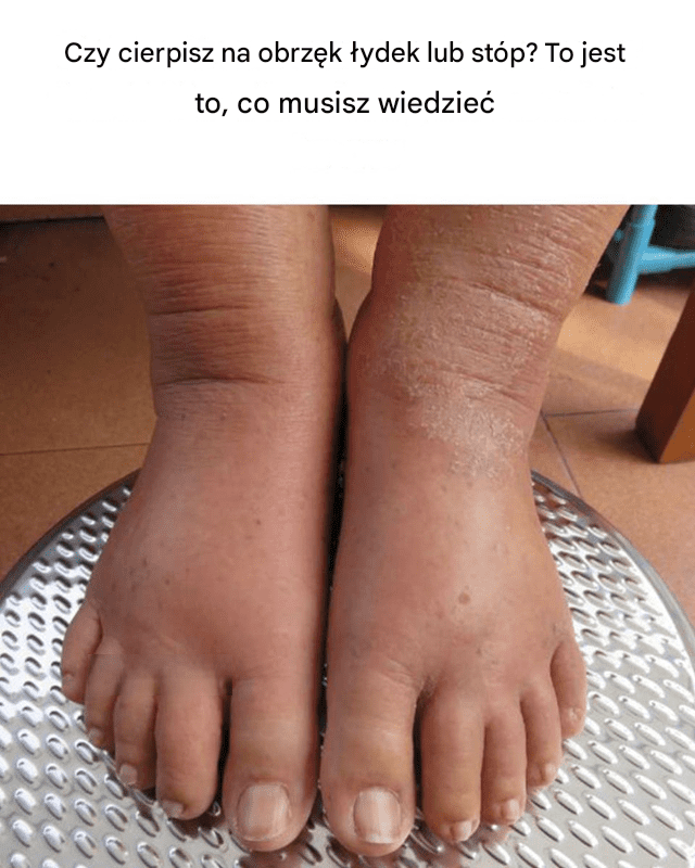 Wi_kszo___ludzi_o_tym_nie_wie Wi_kszo___ludzi_o_tym_nie_wie