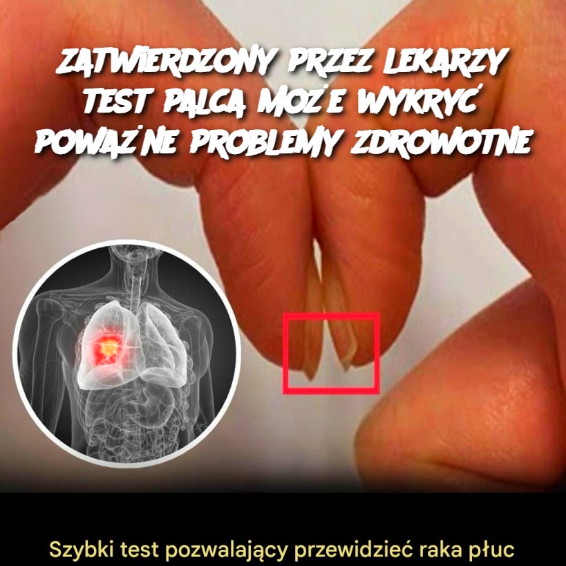 Zatwierdzony_przez_lekarzy_test_palca_mo_e_wykry__powa_ne_problemy_zdrowotne Zatwierdzony_przez_lekarzy_test_palca_mo_e_wykry__powa_ne_problemy_zdrowotne