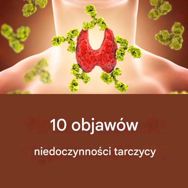 10_objaw_w_niedoczynno_ci_tarczycy__Zidentyfikuj_oznaki 10_objaw_w_niedoczynno_ci_tarczycy__Zidentyfikuj_oznaki