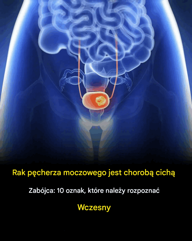 10_objaw_w_raka_p_cherza_moczowego__na_kt_re_nale_y_zwr_ci__uwag_-1
