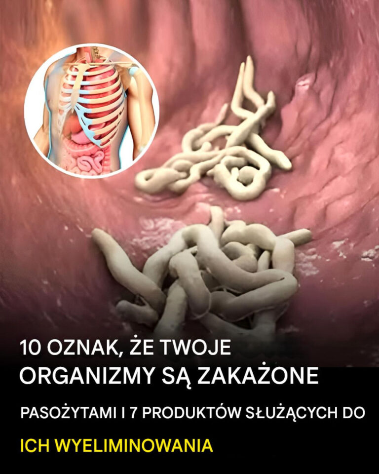 10_oznak___e_w_twoim_ciele_jest_pe_no_paso_yt_w