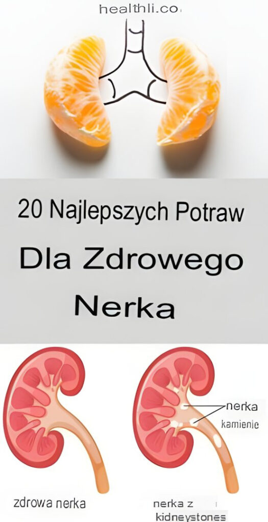 20_najlepszych_produkt_w_spo_ywczych_dla_zdrowia_nerek 20_najlepszych_produkt_w_spo_ywczych_dla_zdrowia_nerek