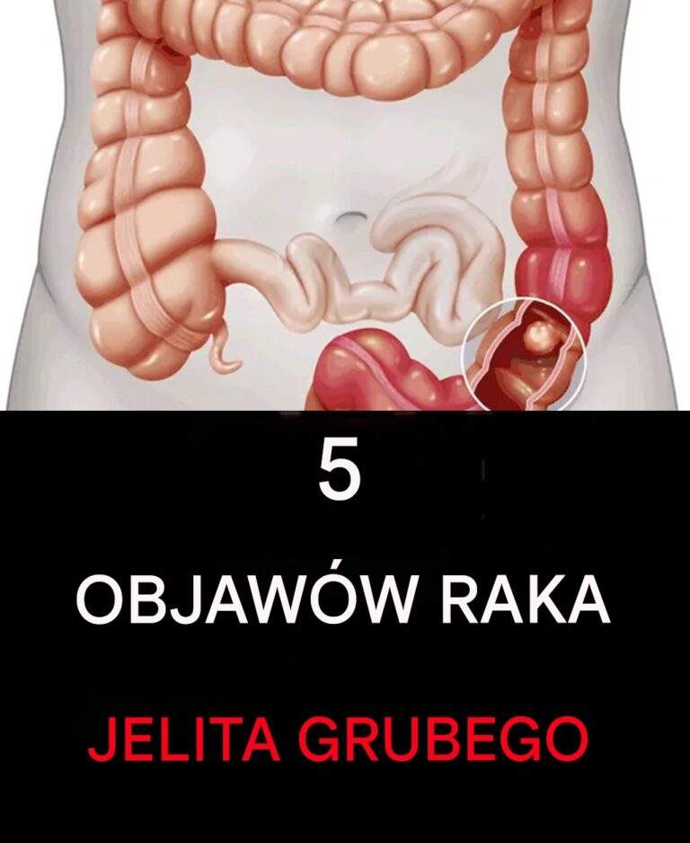 5_oznak_raka_jelita_grubego