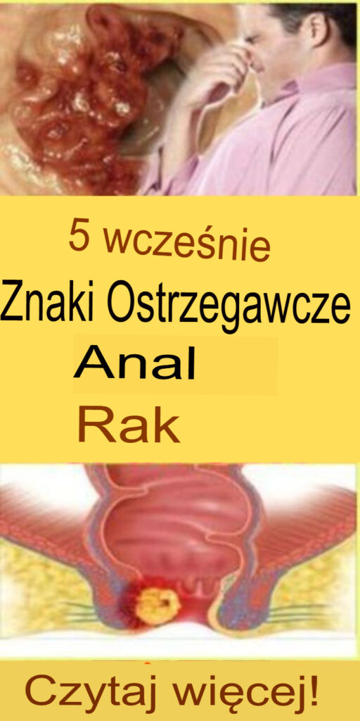 5_wczesnych_ostrzegawczych_objaw_w_raka_odbytu 5_wczesnych_ostrzegawczych_objaw_w_raka_odbytu