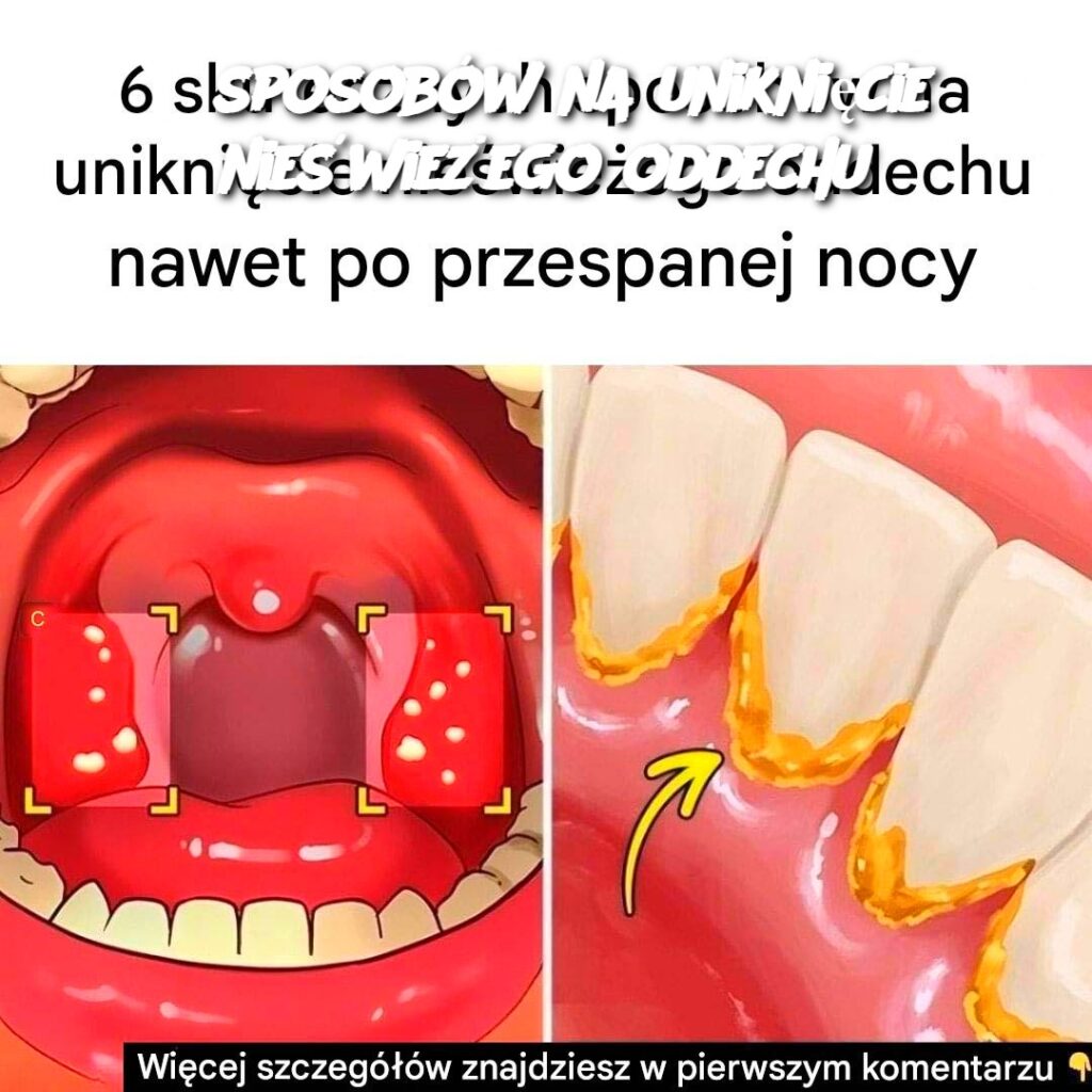 6_sposob_w_na_unikni_cie_nie_wie_ego_oddechu 6_sposob_w_na_unikni_cie_nie_wie_ego_oddechu